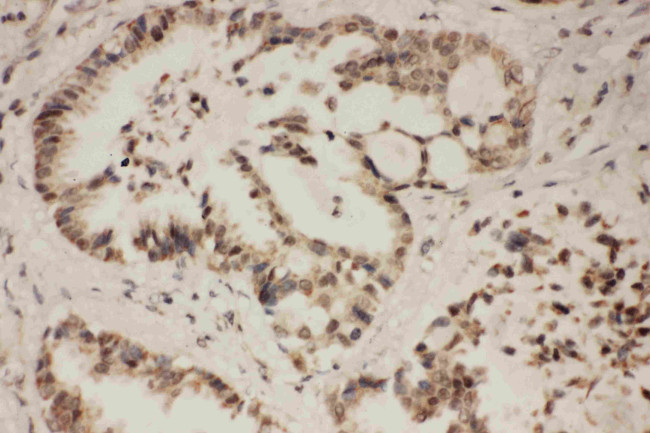 FGFR1 Antibody in Immunohistochemistry (Paraffin) (IHC (P))