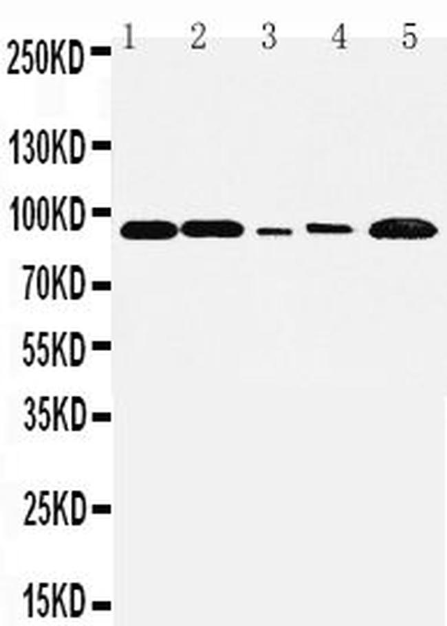 FGFR1 Antibody in Western Blot (WB)