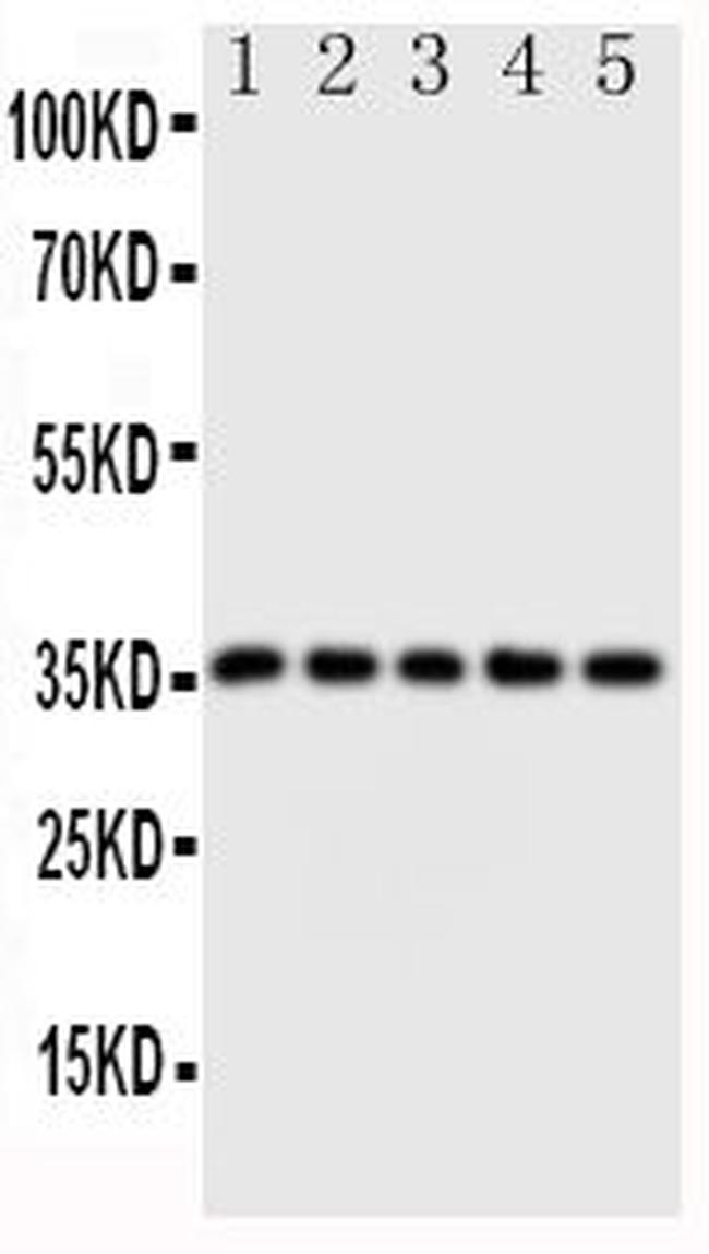 FosB Antibody in Western Blot (WB)