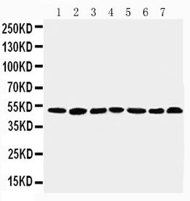 CtBP1 Antibody in Western Blot (WB)