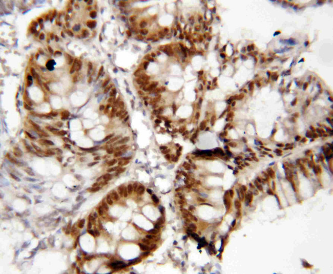 FOXP1 Antibody in Immunohistochemistry (Paraffin) (IHC (P))