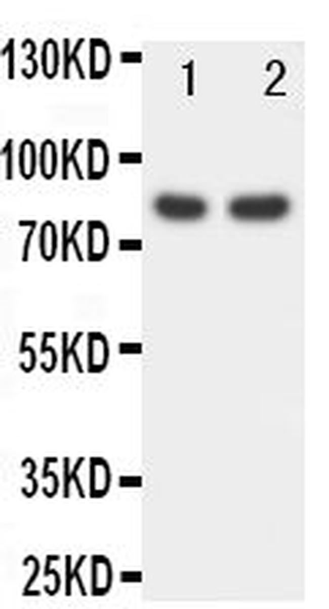 FOXP1 Antibody in Western Blot (WB)