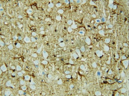 HSF2 Antibody in Immunohistochemistry (Paraffin) (IHC (P))