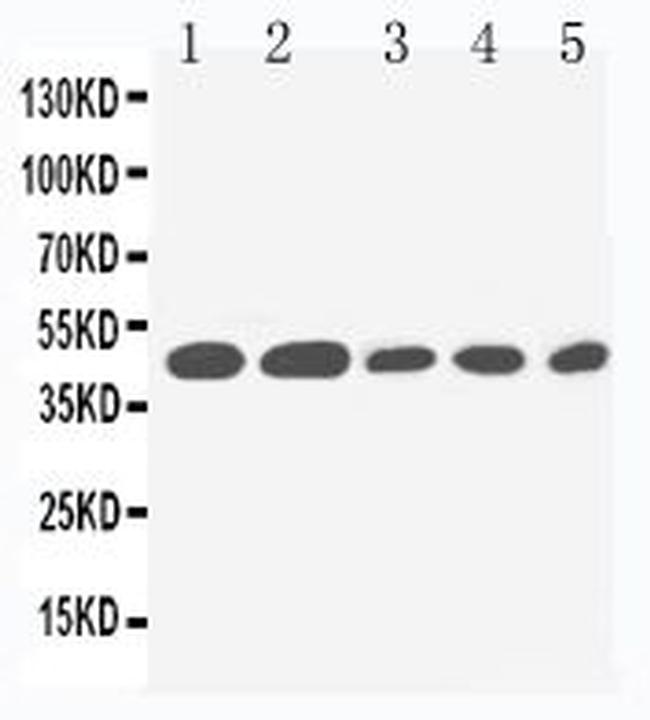 IL2RG Antibody in Western Blot (WB)