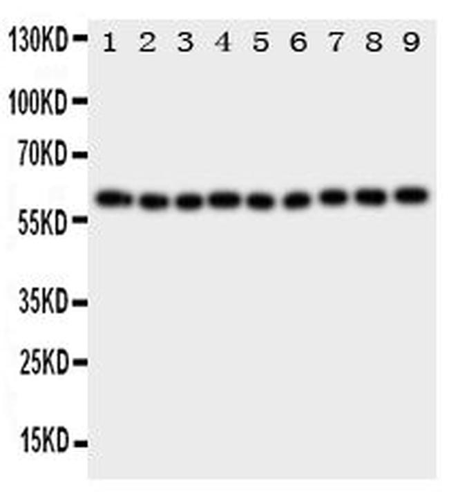 IL5RA Antibody in Western Blot (WB)