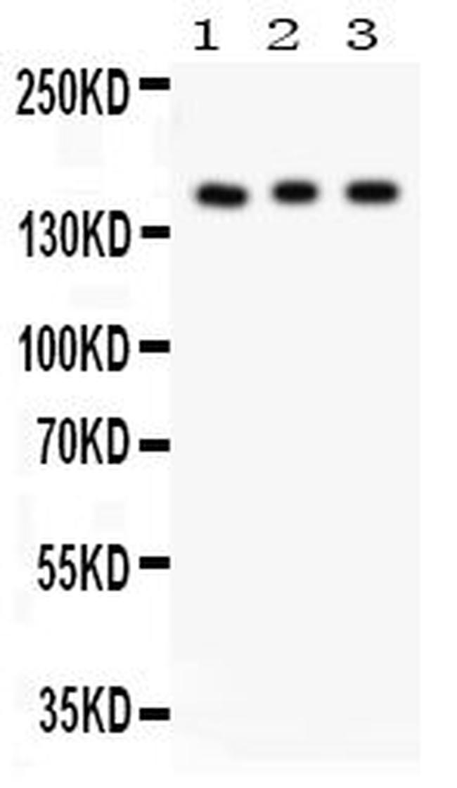 INSR Antibody in Western Blot (WB)