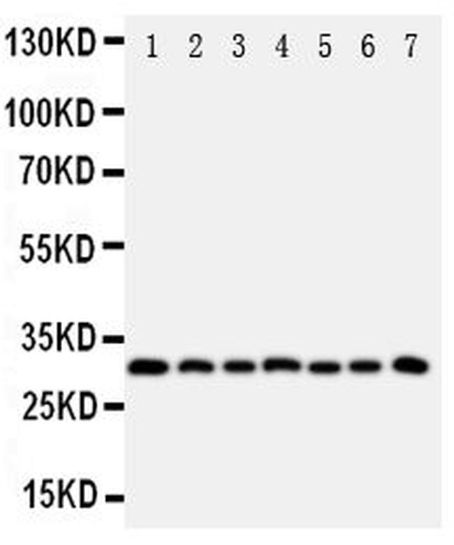 Kallikrein 11 Antibody in Western Blot (WB)