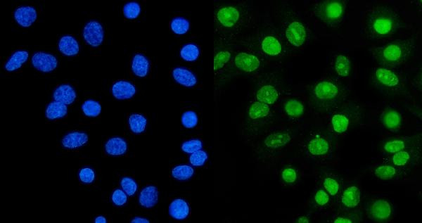 Ku70 Antibody in Immunocytochemistry (ICC/IF)