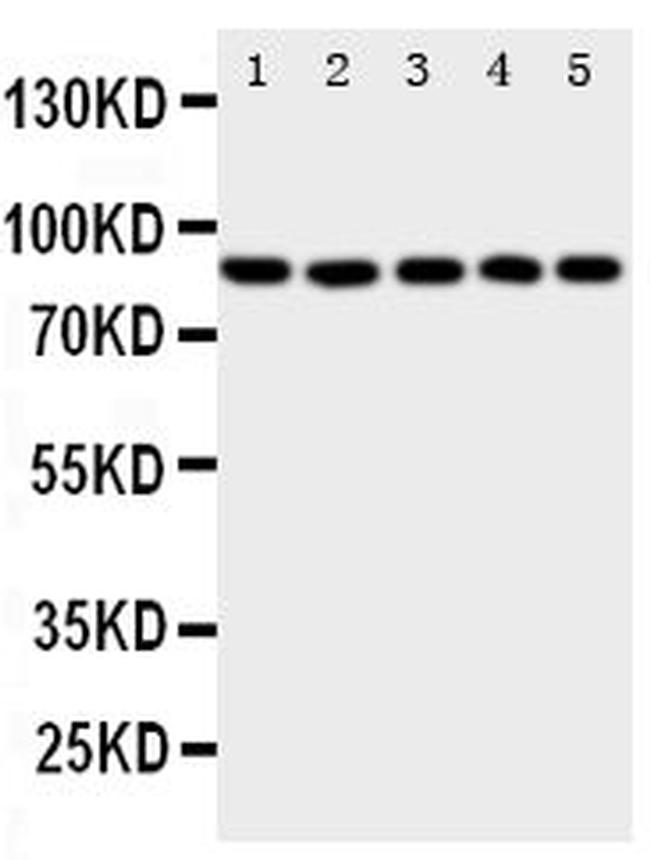 ALOX5 Antibody in Western Blot (WB)