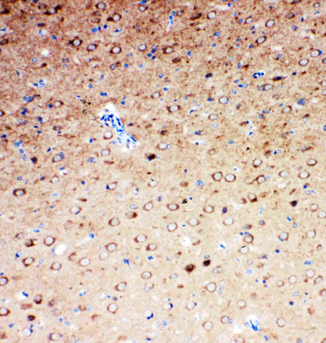 SLC6A4 Antibody in Immunohistochemistry (Paraffin) (IHC (P))