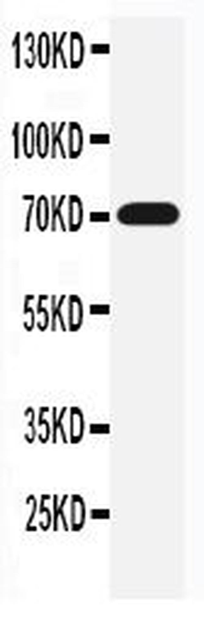 SLC6A4 Antibody in Western Blot (WB)