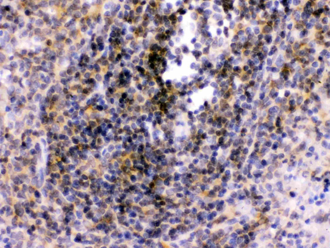 TLR7 Antibody in Immunohistochemistry (Paraffin) (IHC (P))