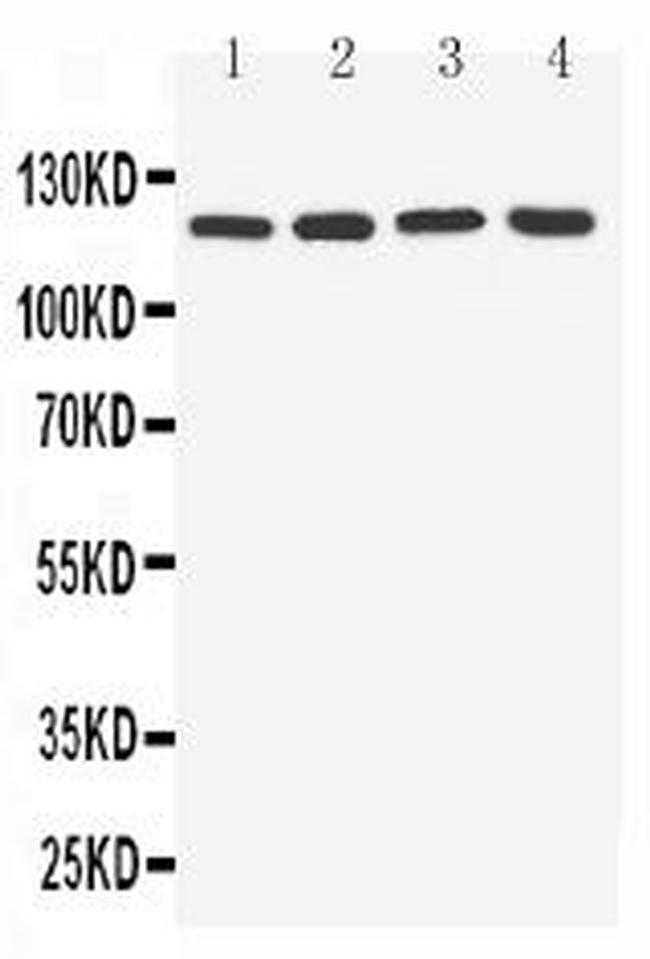 TLR7 Antibody in Western Blot (WB)