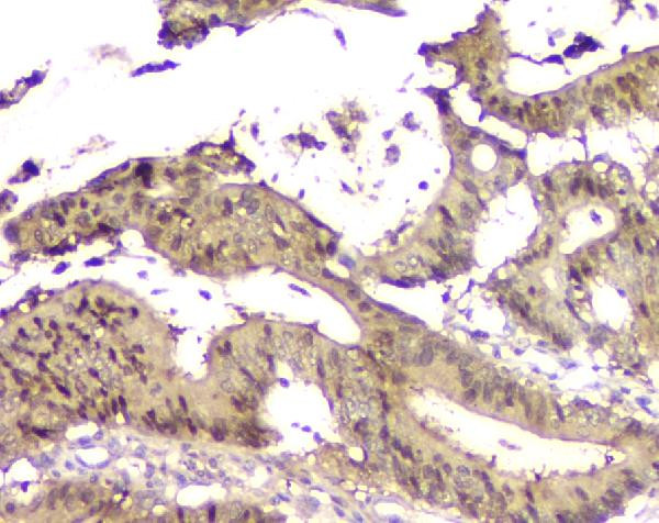 14-3-3 sigma Antibody in Immunohistochemistry (Paraffin) (IHC (P))