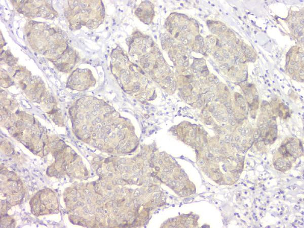 14-3-3 sigma Antibody in Immunohistochemistry (Paraffin) (IHC (P))