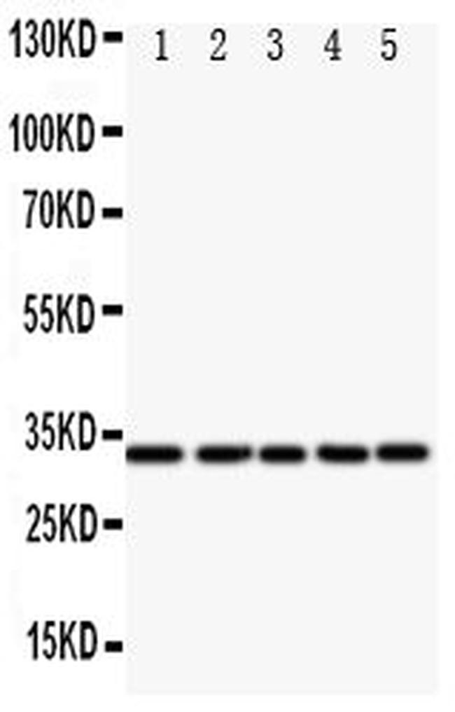 E2F6 Antibody in Western Blot (WB)
