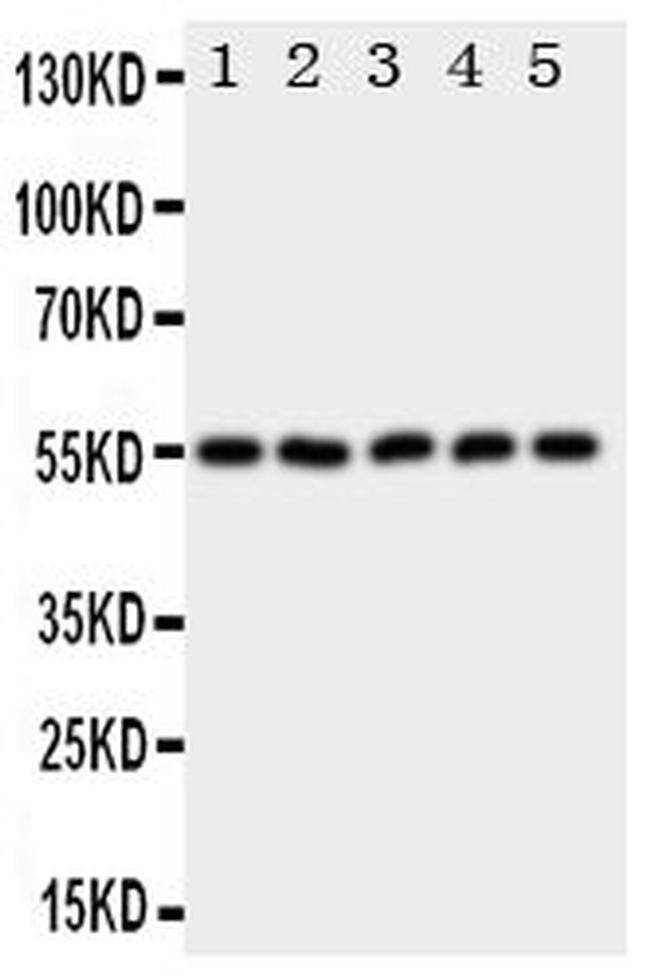 HYAL2 Antibody in Western Blot (WB)