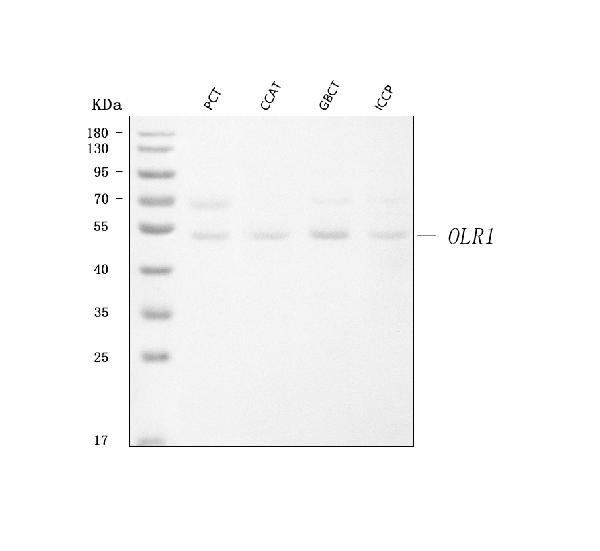 LOX-1 Antibody in Western Blot (WB)