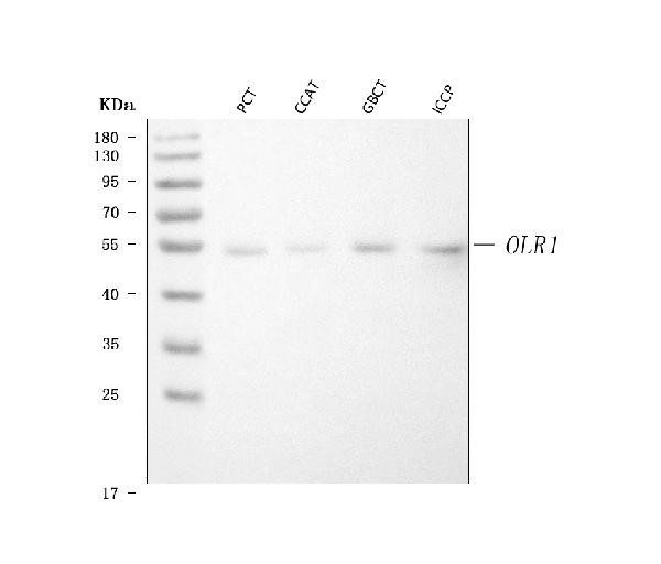 LOX-1 Antibody in Western Blot (WB)