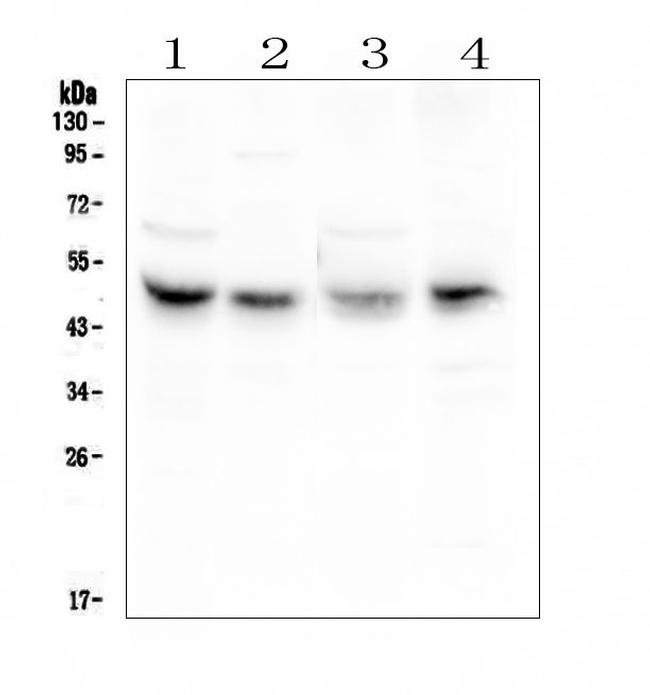 CAR Antibody in Western Blot (WB)