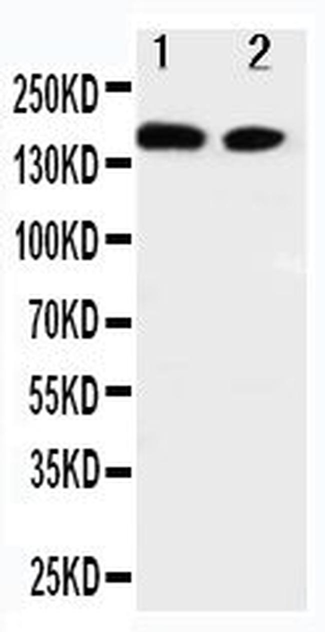 ErbB4 Antibody in Western Blot (WB)