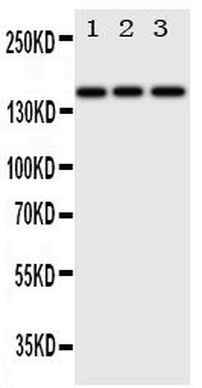 ErbB4 Antibody in Western Blot (WB)