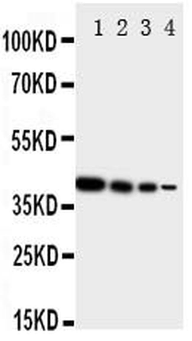 ErbB4 Antibody in Western Blot (WB)