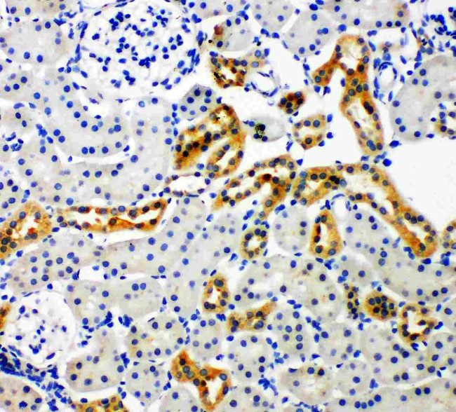 NOX4 Antibody in Immunohistochemistry (Paraffin) (IHC (P))