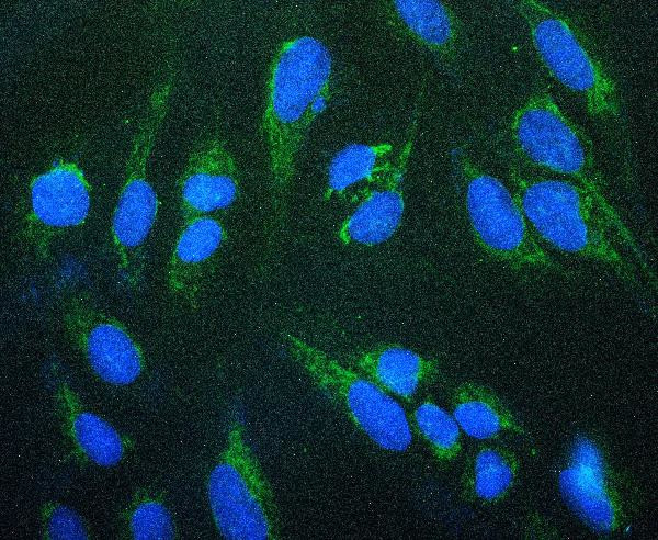 Prohibitin Antibody in Immunocytochemistry (ICC/IF)