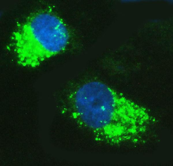 SQSTM1 Antibody in Immunocytochemistry (ICC/IF)