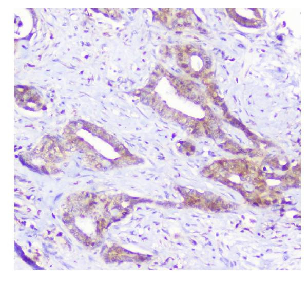 SQSTM1 Antibody in Immunohistochemistry (Paraffin) (IHC (P))