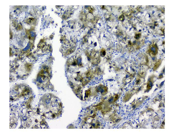 SQSTM1 Antibody in Immunohistochemistry (Paraffin) (IHC (P))