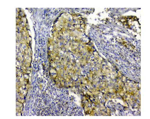 SQSTM1 Antibody in Immunohistochemistry (Paraffin) (IHC (P))