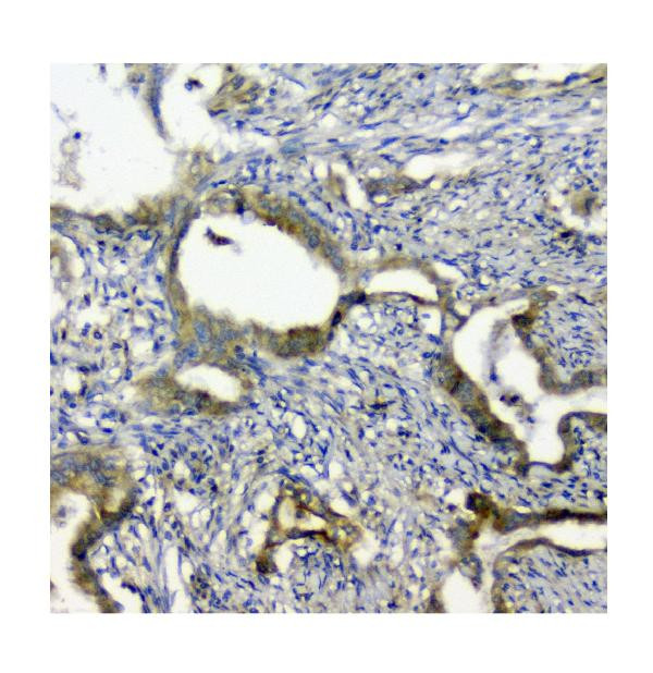 SQSTM1 Antibody in Immunohistochemistry (Paraffin) (IHC (P))