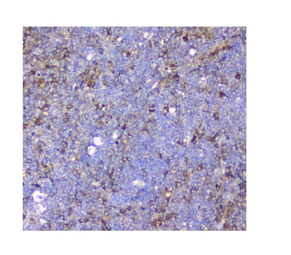 SQSTM1 Antibody in Immunohistochemistry (Paraffin) (IHC (P))