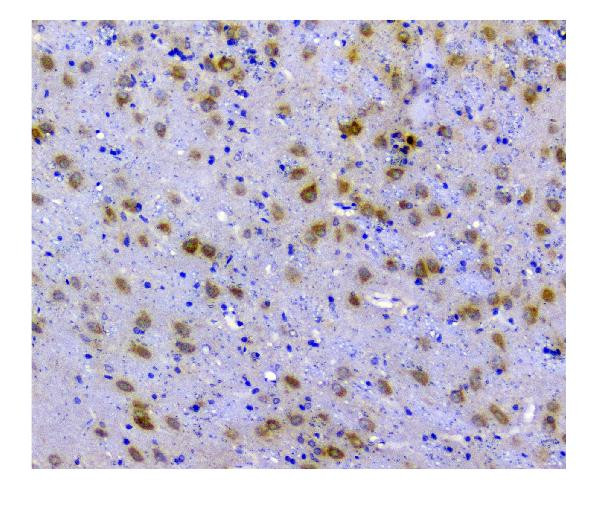 SQSTM1 Antibody in Immunohistochemistry (Paraffin) (IHC (P))