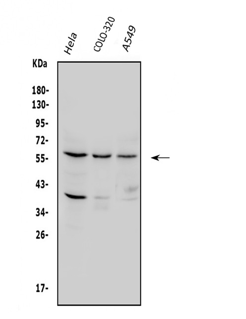 SQSTM1 Antibody in Western Blot (WB)