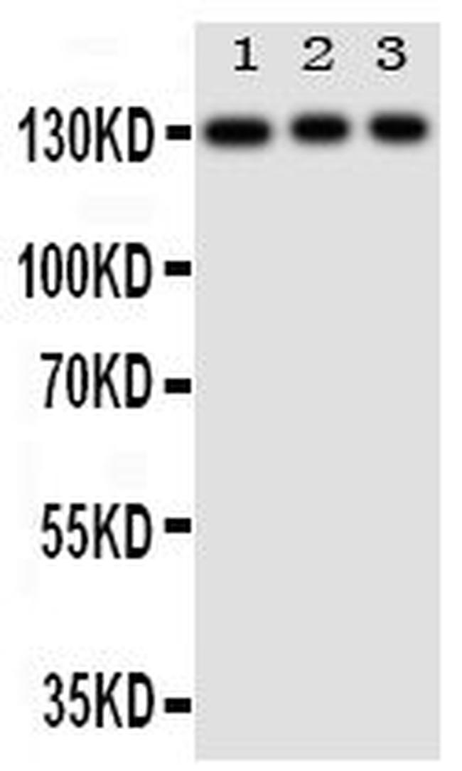 TLR10 Antibody in Western Blot (WB)