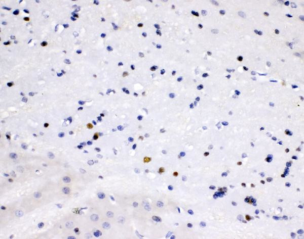 ZEB2 Antibody in Immunohistochemistry (Paraffin) (IHC (P))