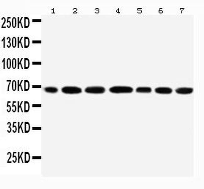 DDX5 Antibody in Western Blot (WB)