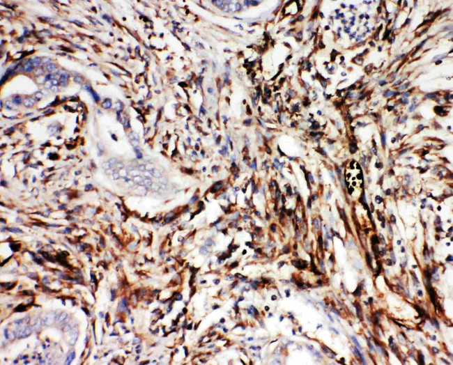 NRG1 Antibody in Immunohistochemistry (Paraffin) (IHC (P))