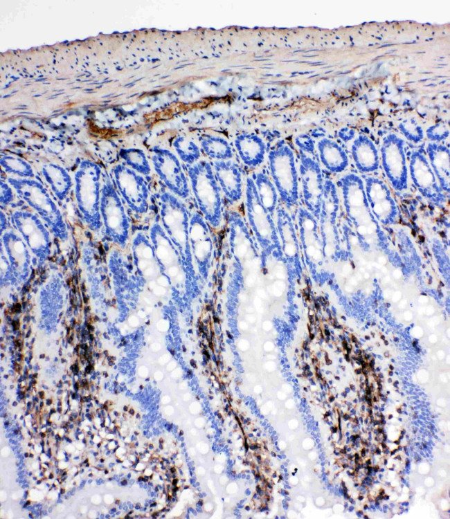 NRG1 Antibody in Immunohistochemistry (Paraffin) (IHC (P))