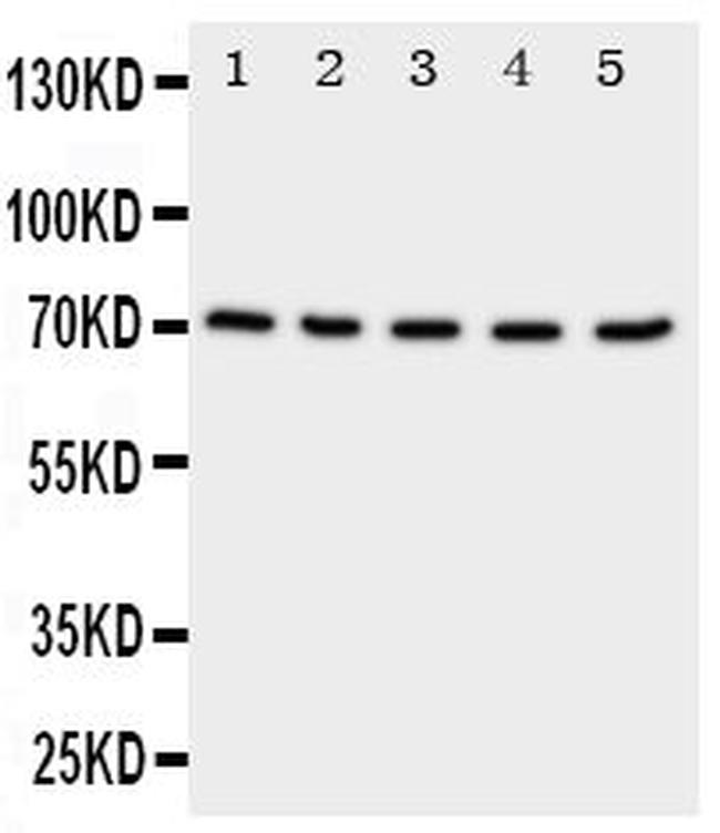 NRG1 Antibody in Western Blot (WB)