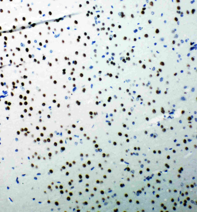 53BP1 Antibody in Immunohistochemistry (Paraffin) (IHC (P))