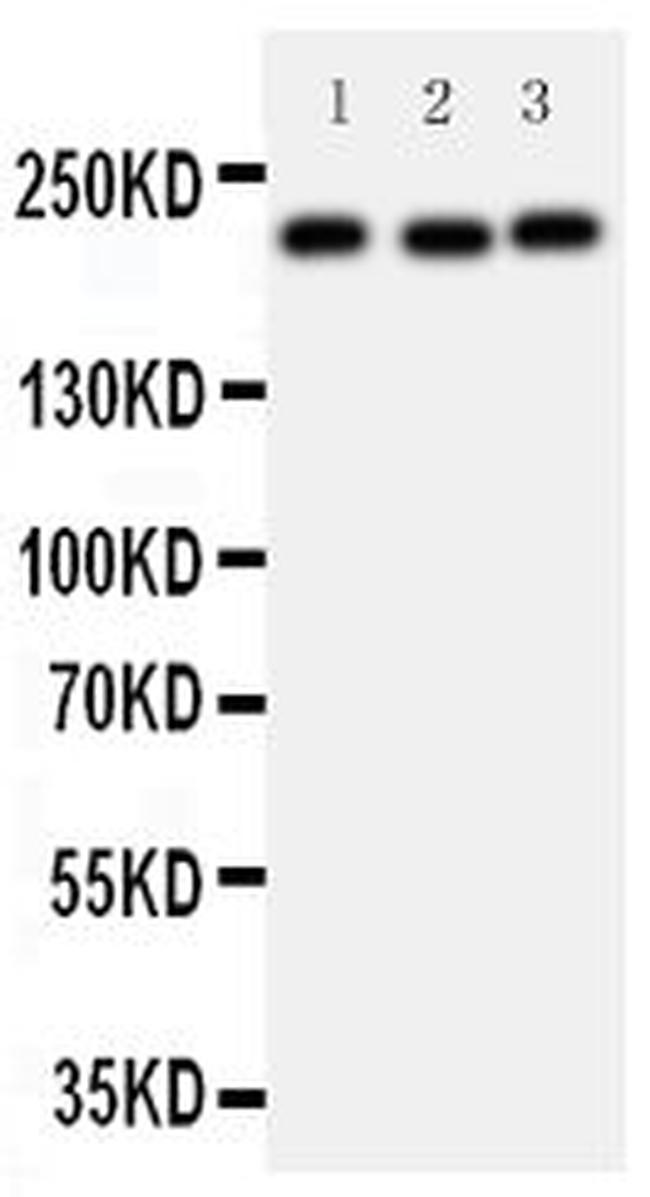 53BP1 Antibody in Western Blot (WB)