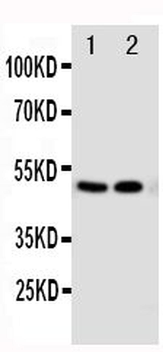 VDR Antibody in Western Blot (WB)