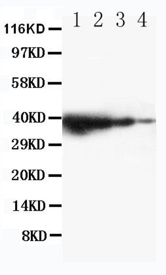 TRIF Antibody in Western Blot (WB)