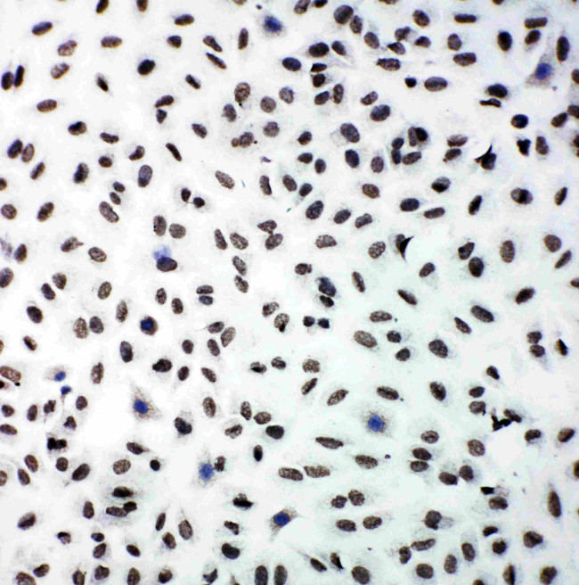 PERK Antibody in Immunocytochemistry (ICC/IF)