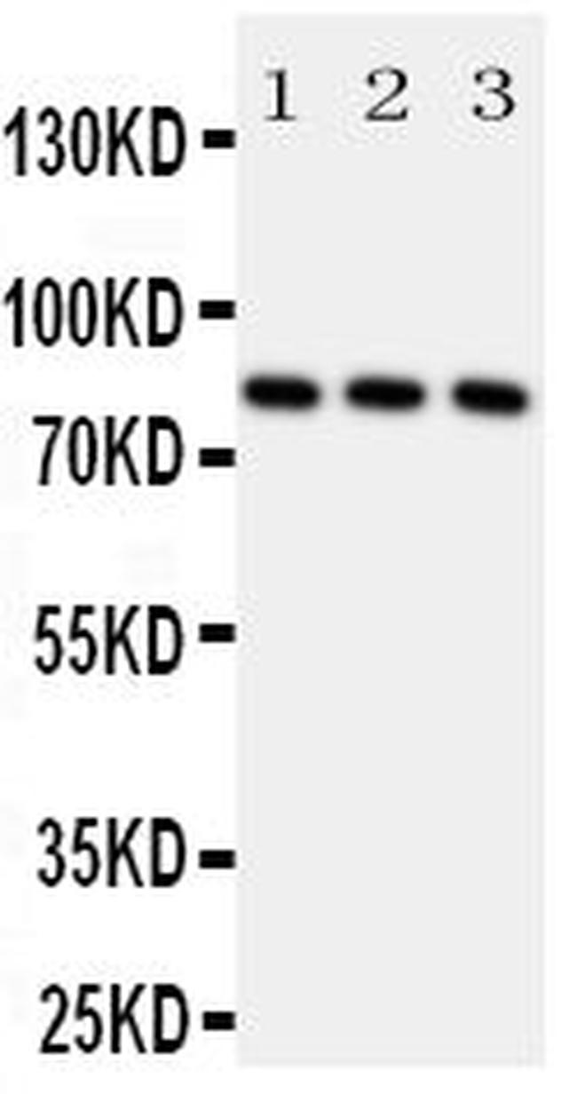 RSK1 Antibody in Western Blot (WB)