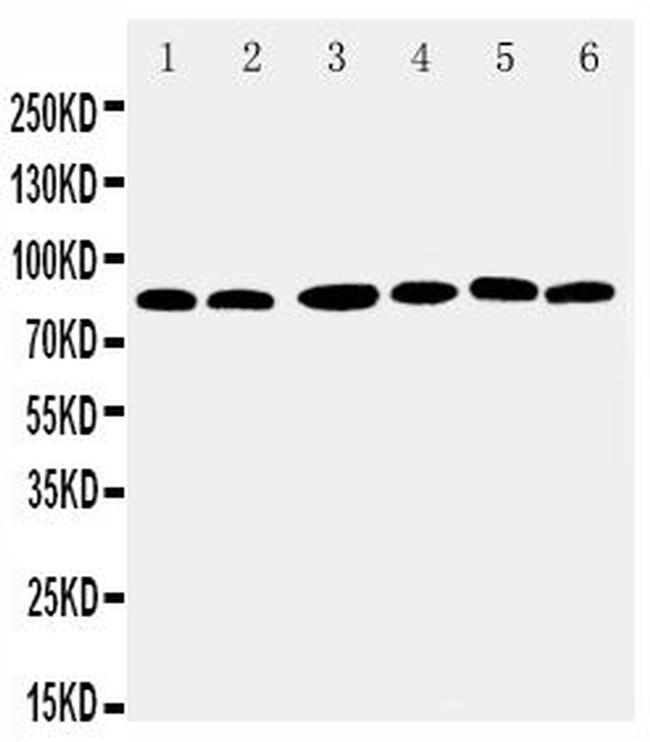 RSK1 Antibody in Western Blot (WB)